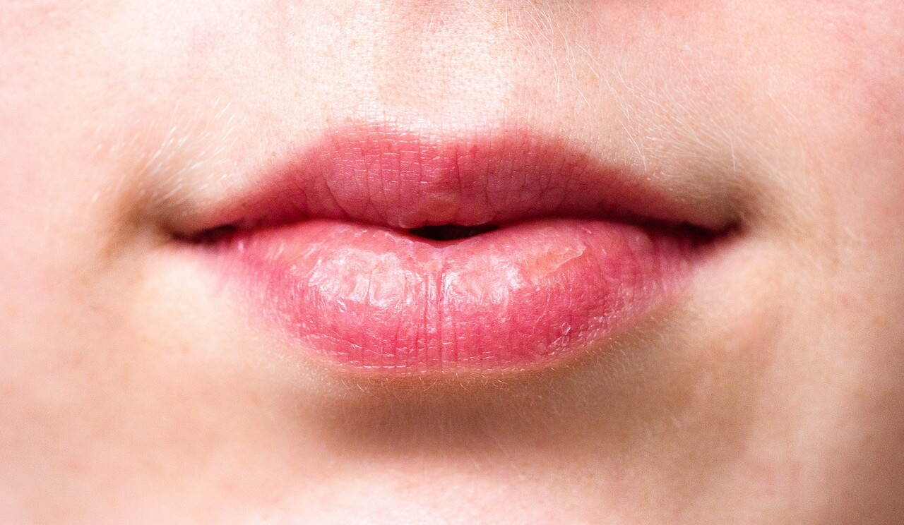 Are Dry Lips During Pregnancy A Gender Revealer?